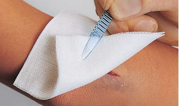 Vliwasoft Vliesstoffkompresse 4-fach, steril-75x2 Kompressen