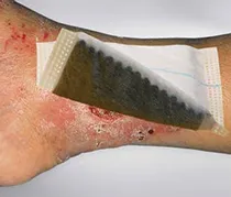 Vliwaktiv Ag Aktivkohle-Tamp. mit Silber steril