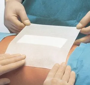 Fixomull, luftdurchlässiger Klebemull