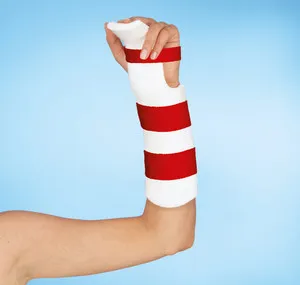 Dynacast ® Prelude Strap Kits Klettverschluss-System